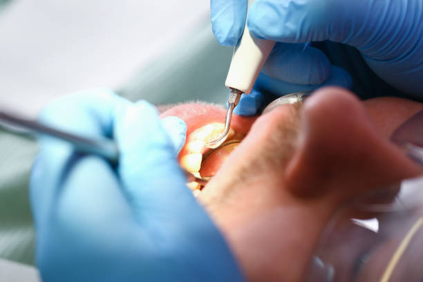 Best Emergency Gum Treatment in Maan, ND