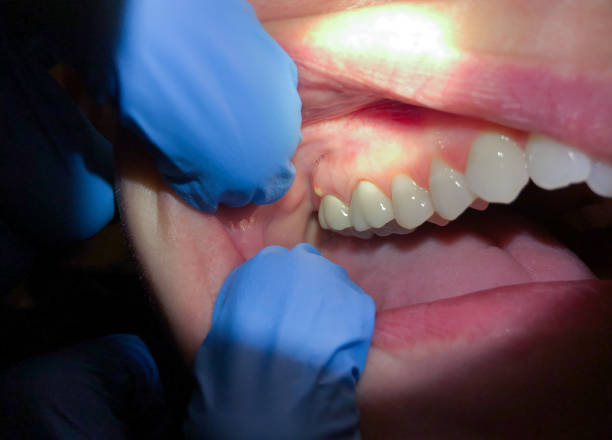 Best Cosmetic Emergency Dentistry in Maan, ND